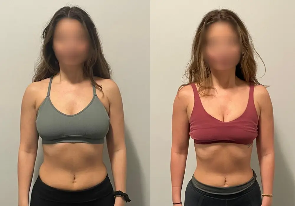 Client Transformation 20