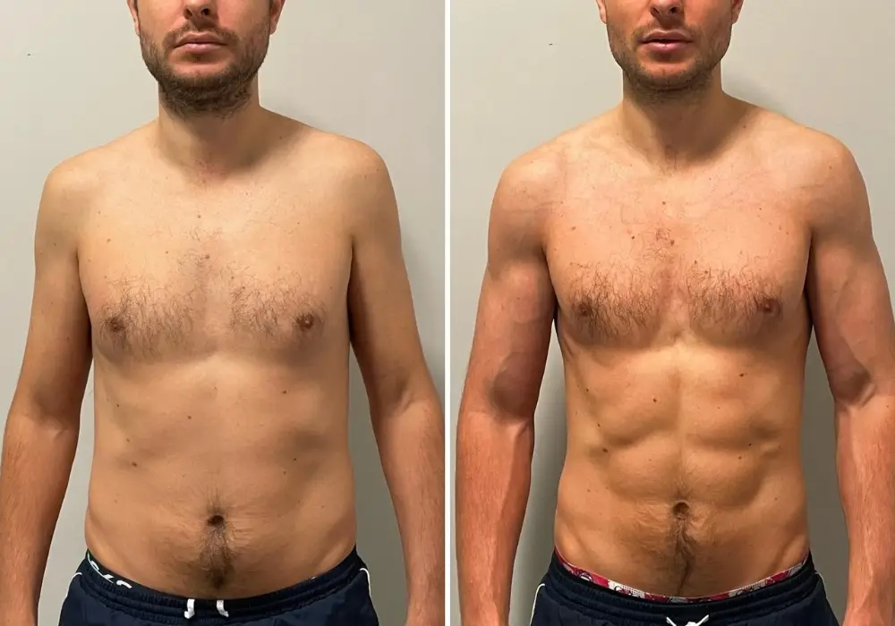 Client Transformation 21
